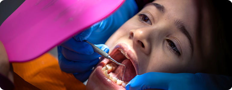 Proceso de formación de caries